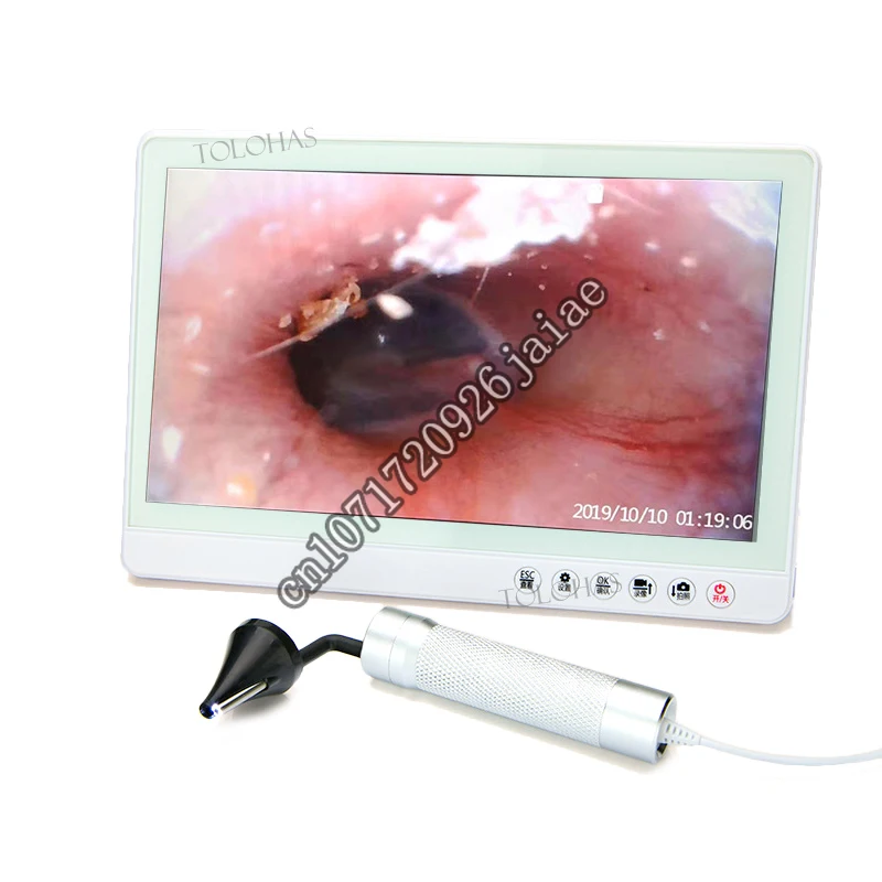 LHGK03 Digital ENT Ear  Endoscope Otolaryngology Examination Eardrum Visible Video Otoscope Set