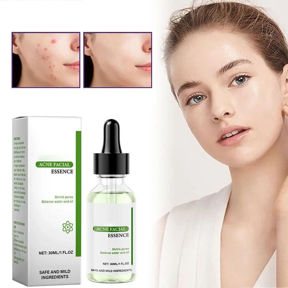 30 мл эффективная жидкость для удаления прыщей, удобная жидкость для удаления прыщей, улучшение прыщей, удобный раствор для восстановления лица, средства по уходу за кожей