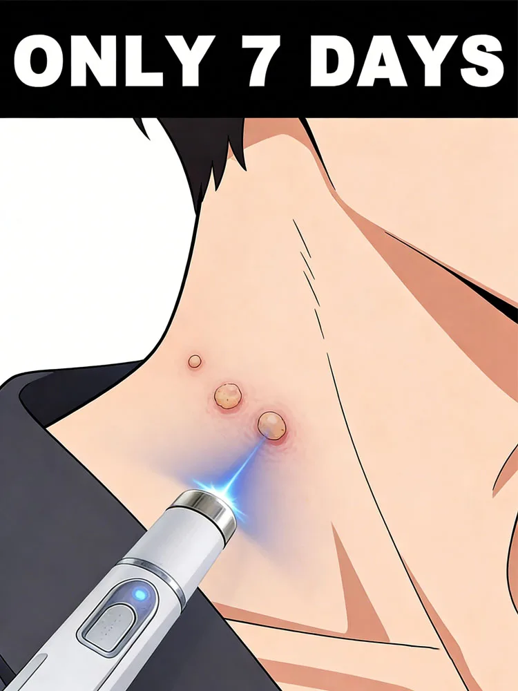 

Новейшая усовершенствованная ручка с синим светом, бестселлер для удаления бородавок, доступна с ещё большими скидками при покупке в комплекте.