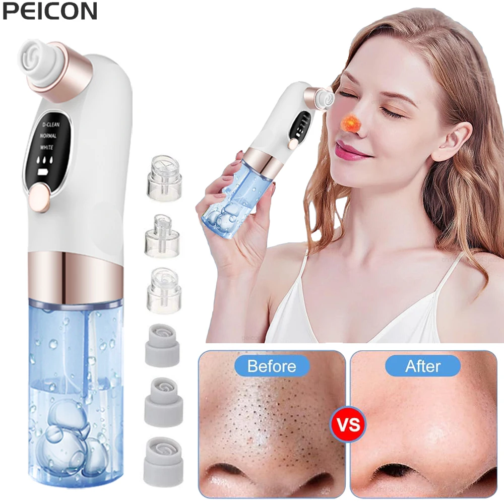 

Electric Blackhead Remover Pore Vacuum Cleaner Facial Black Dots Vacuum Cleaner Pimple Acne Blackhead Removal Black Dots Remover