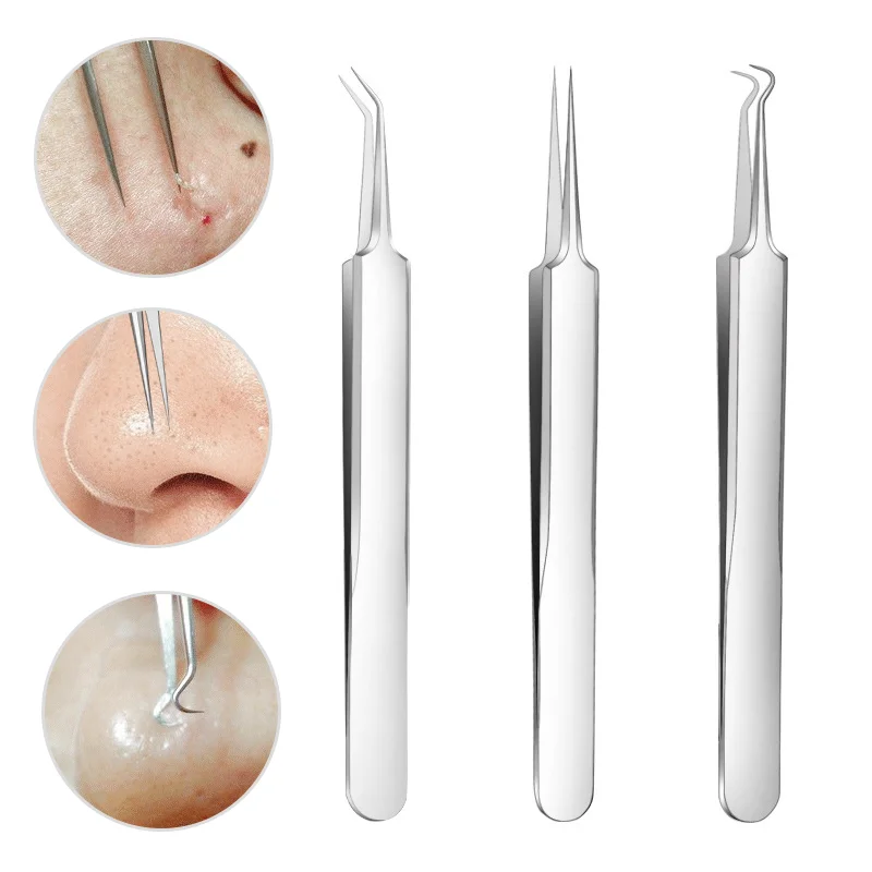 Extra Fine Cellular Acne Blackhead Tweezers Facial Beauty Remove Acne Needle Tools Pimple Extractor Skin Care Whitehead Removal