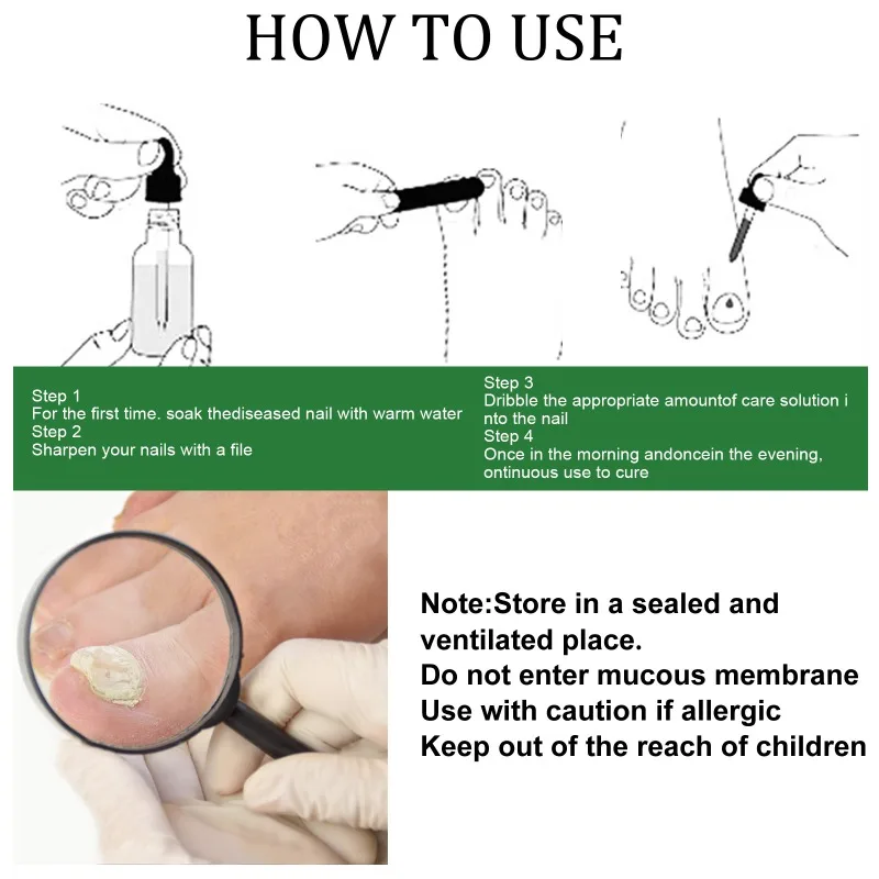 حل فعال لإصلاح الأظافر لعلاج تشقق الأظافر ، تغير لونها ، رمادي العناية بالقدم ، جل تعقيم الأظافر لأصابع القدم ، جوهر مغذي