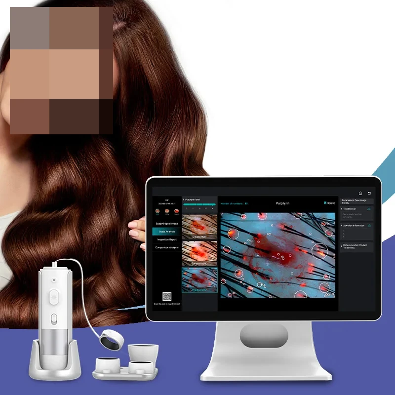 

AI Intelligent Analysis Hair Tester Skin Analyzer Analysis Scalp Care With Cloud Data Storage Hair Analysis Machine