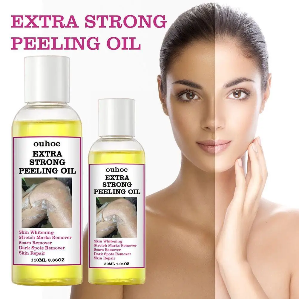 30ML Extra Strong Yellow Peeling Oil Whitening Lighten Care Skin Even Elbows Whiten Skin Hands Knees Tone E7X0