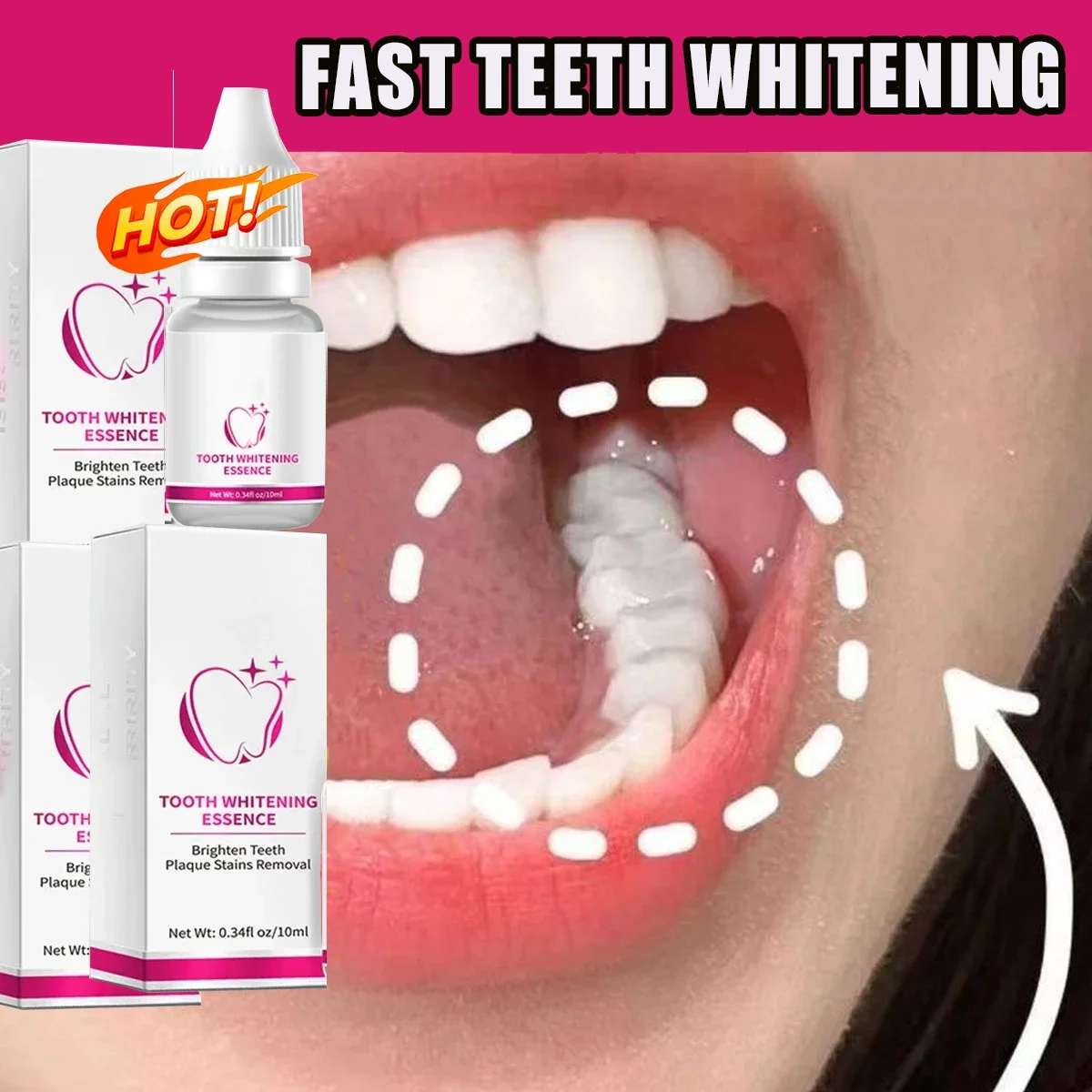 

Teeth whitening teeth cleaning Tooth decay repair Repair all tooth decay,Cigarette Stains Reduce Yellow cavities and protect