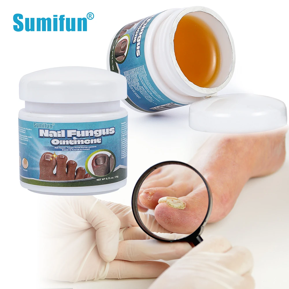 

Лечебный крем для ногтей Sumifun Paronychia, 20 г, удаление грибка, травяная мазь, онихомикоз, восстанавливающий противоинфекционный продукт для ухода за ногами