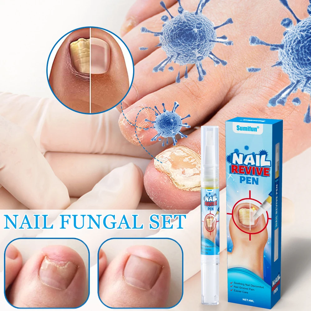 Nail Fungus Laser Treatment Toenail Repair Fingernail Device Nail Treatment Foot Nail Fungus Cream & Pen Onychomycosis Care Tool