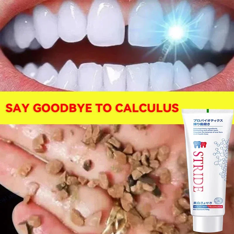 Dental Calculus Remover Whitening Teeth Mouth Odour Removal Bad Breath Preventing Periodontitis 2024 New