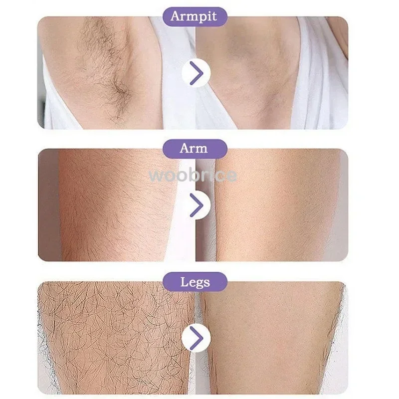 مزيل الشعر غير مؤلم لشعر الساق ، نزع الشعر الكريستالي القابل لإعادة الاستخدام ، إزالة الشعر البدني ، مزيل الزجاج
