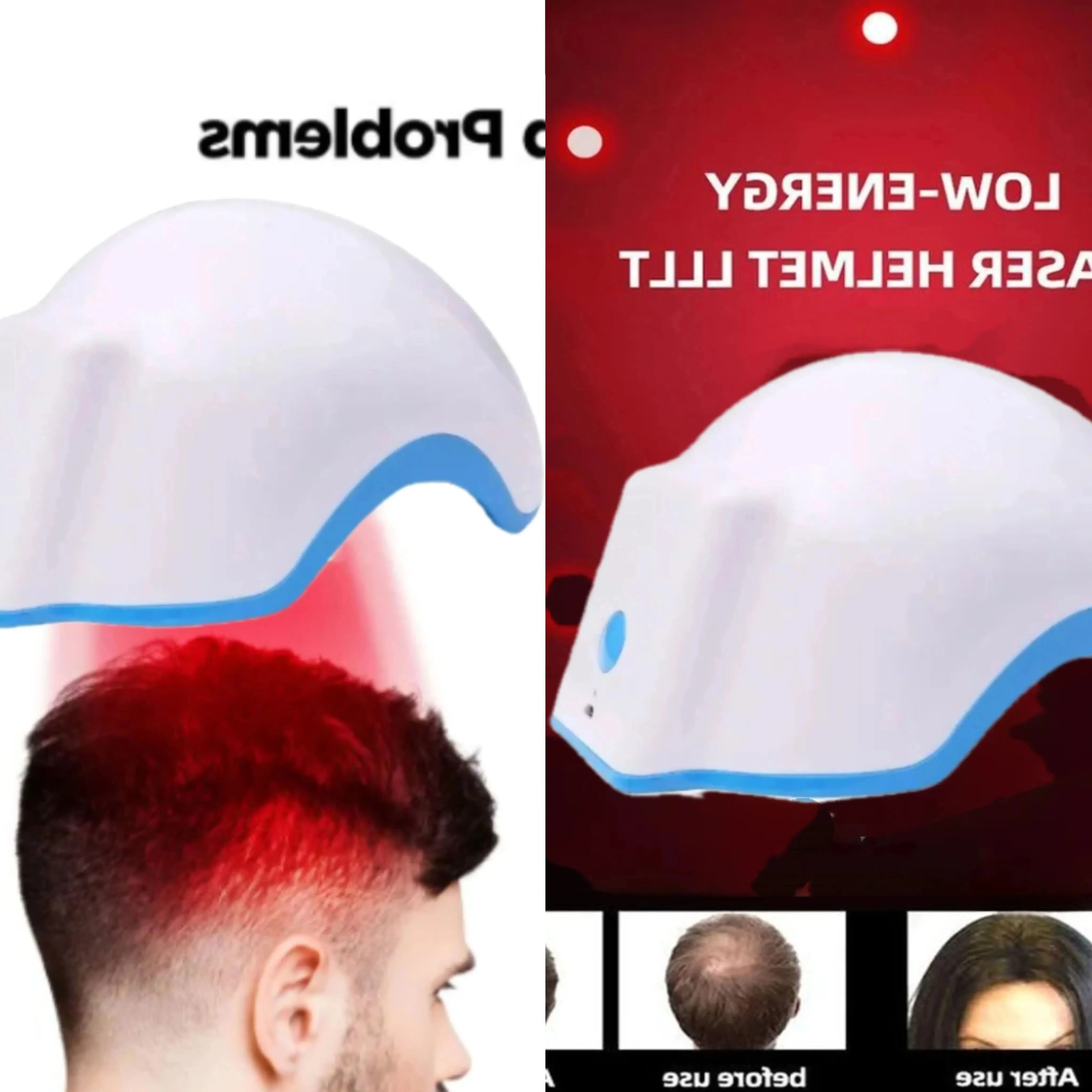 

Red Light Scalp Hat Massager LED Hair Growth Hat Infrared Scalp Anti-Hair Loss Headache Relief Hair Loss Care Device
