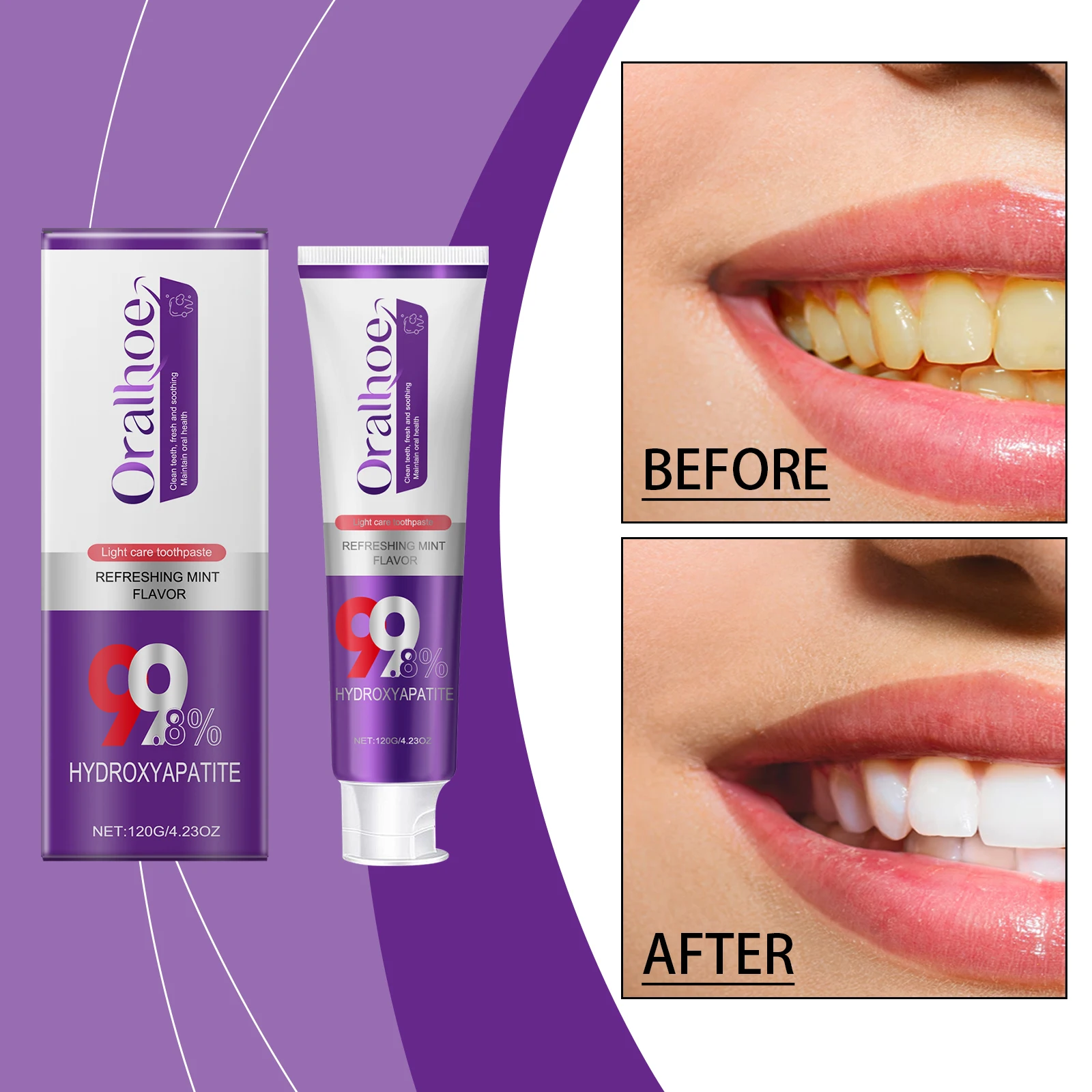 Anti-yellow Toothpaste Removes Smoke Stains, Freshens Breath, Effectively Brightens and Protects Tooth Enamel Oral Care