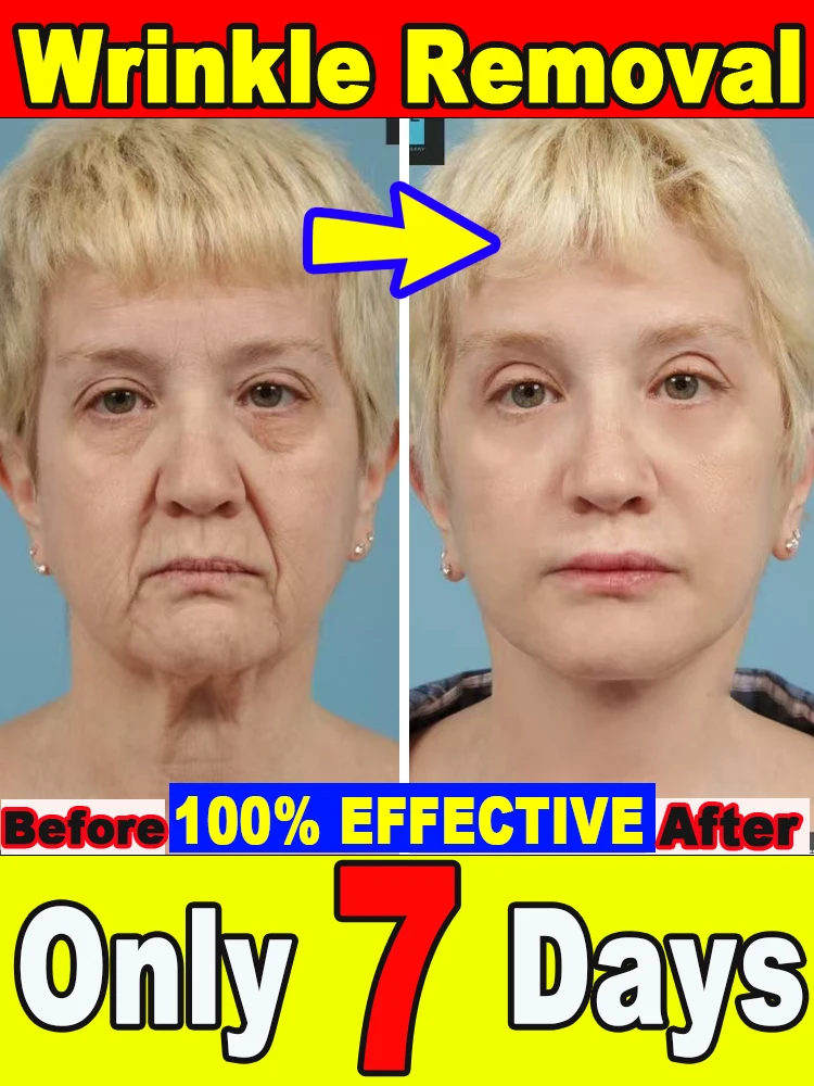 

20-летний младший