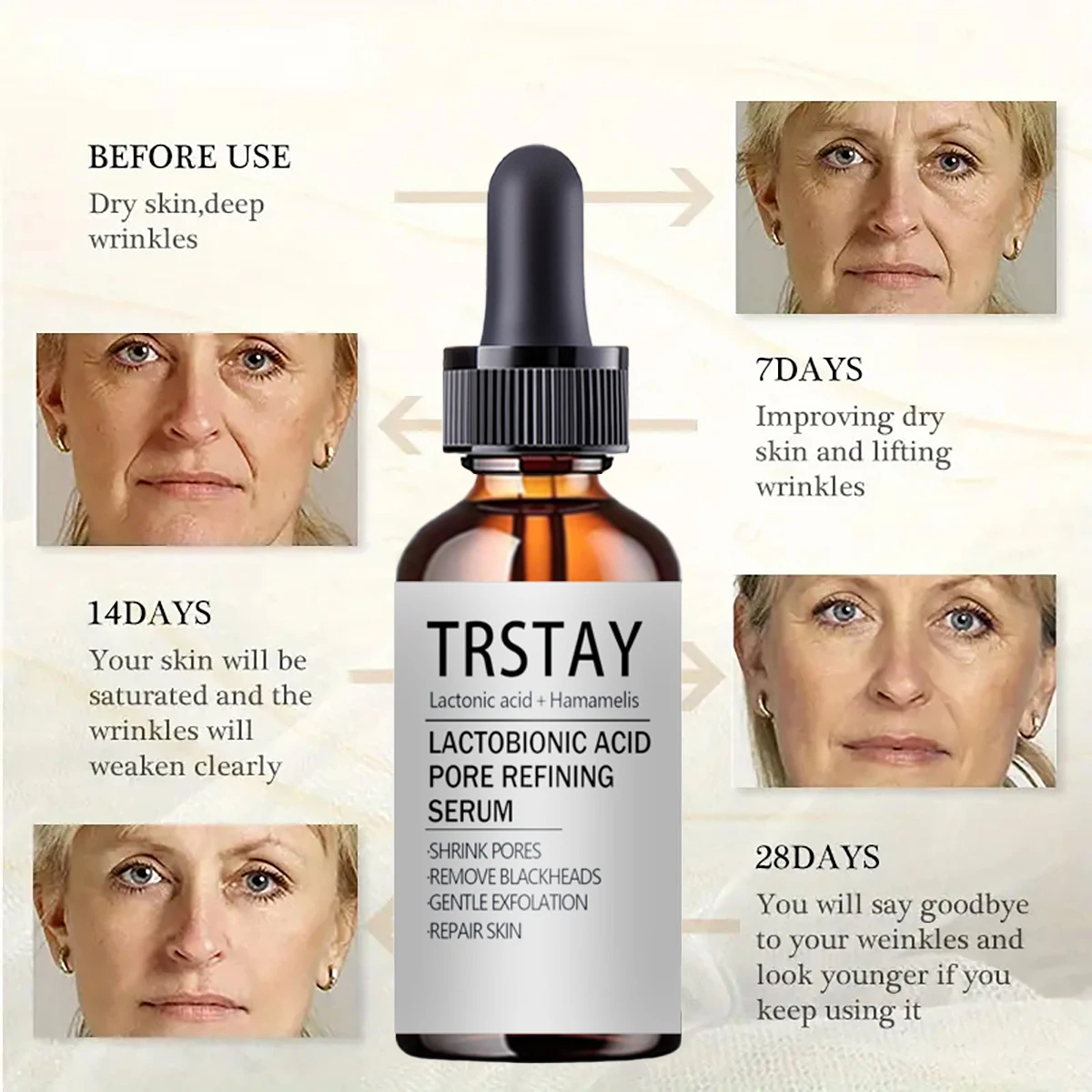 TRSTAY-Sulfose حمض بيونيك ، جوهر المسام الطبيعي ، يضيء لون البشرة ، يرطب ، يقلل التأخير ويشد البشرة