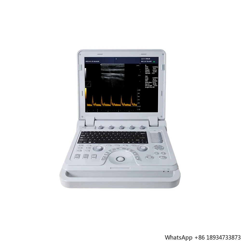 Machine Portable Color Doppler