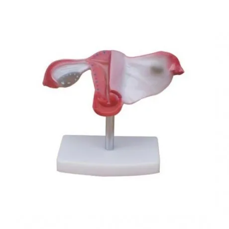 

Natural large uterus model, medical and gynecological anatomy and family planning demonstration model