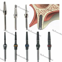 Expander Implant Split Drill Narrow Ridge Expansion Screws Titanium Coat Hiossen 8Size