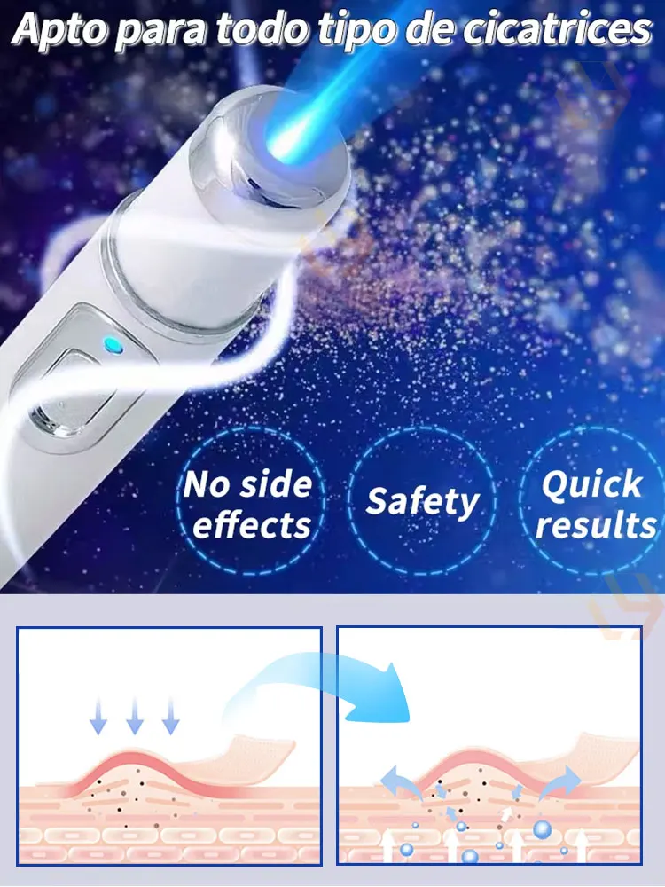Bolígrafos láser de 2 generaciones para resolver tus problemas de cicatrices y mantener la piel sana.