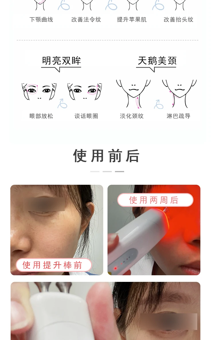 Free Shipping Firming Lifting Eye Beautification Instrument Facial Essence Inductive Therapeutical Instrument Eye Fade Eye