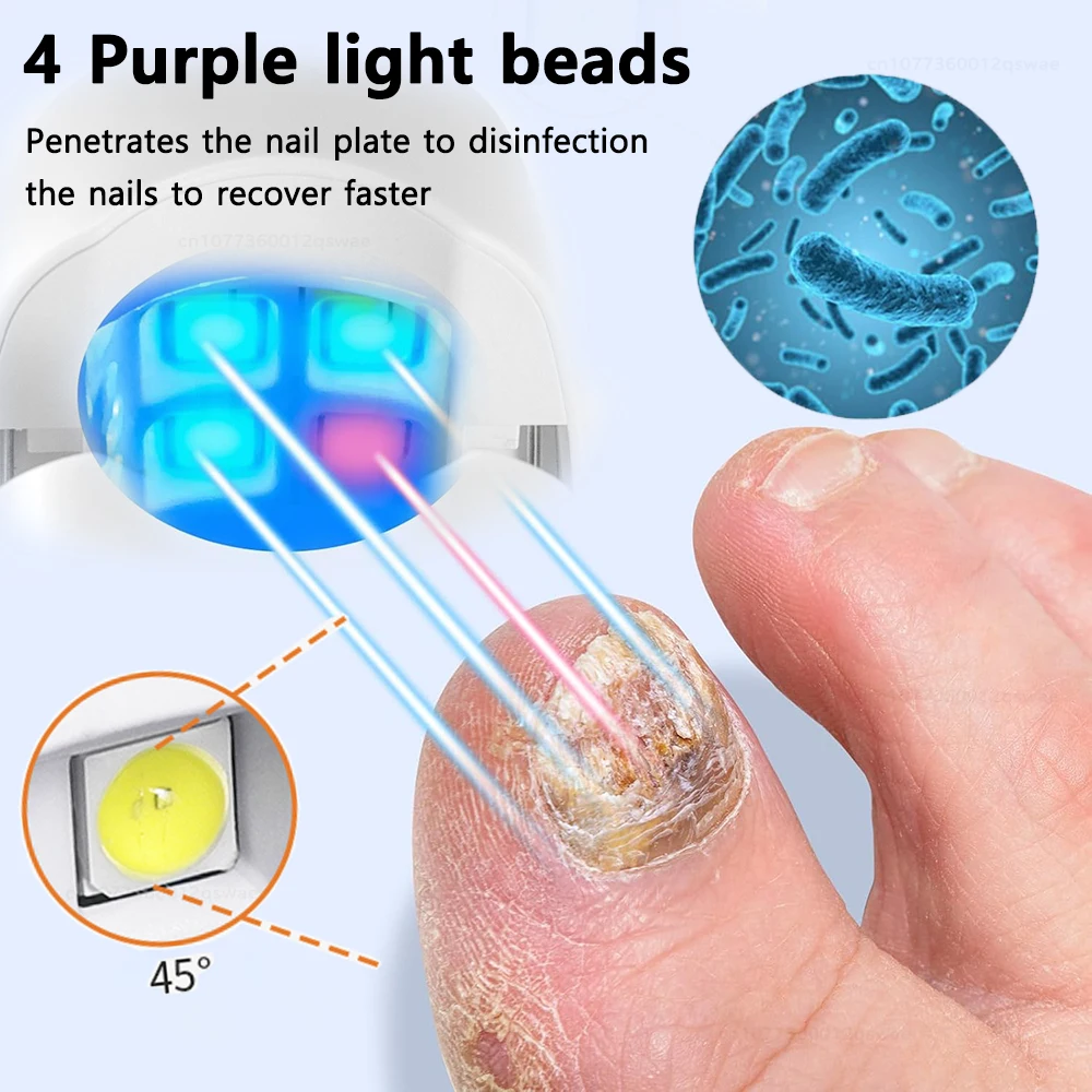 جهاز فطريات الأظافر بالليزر لأظافر القدم المتعددة أظافر فطار الأظافر إصلاح الأظافر معدات ليزر مضادة للفطريات