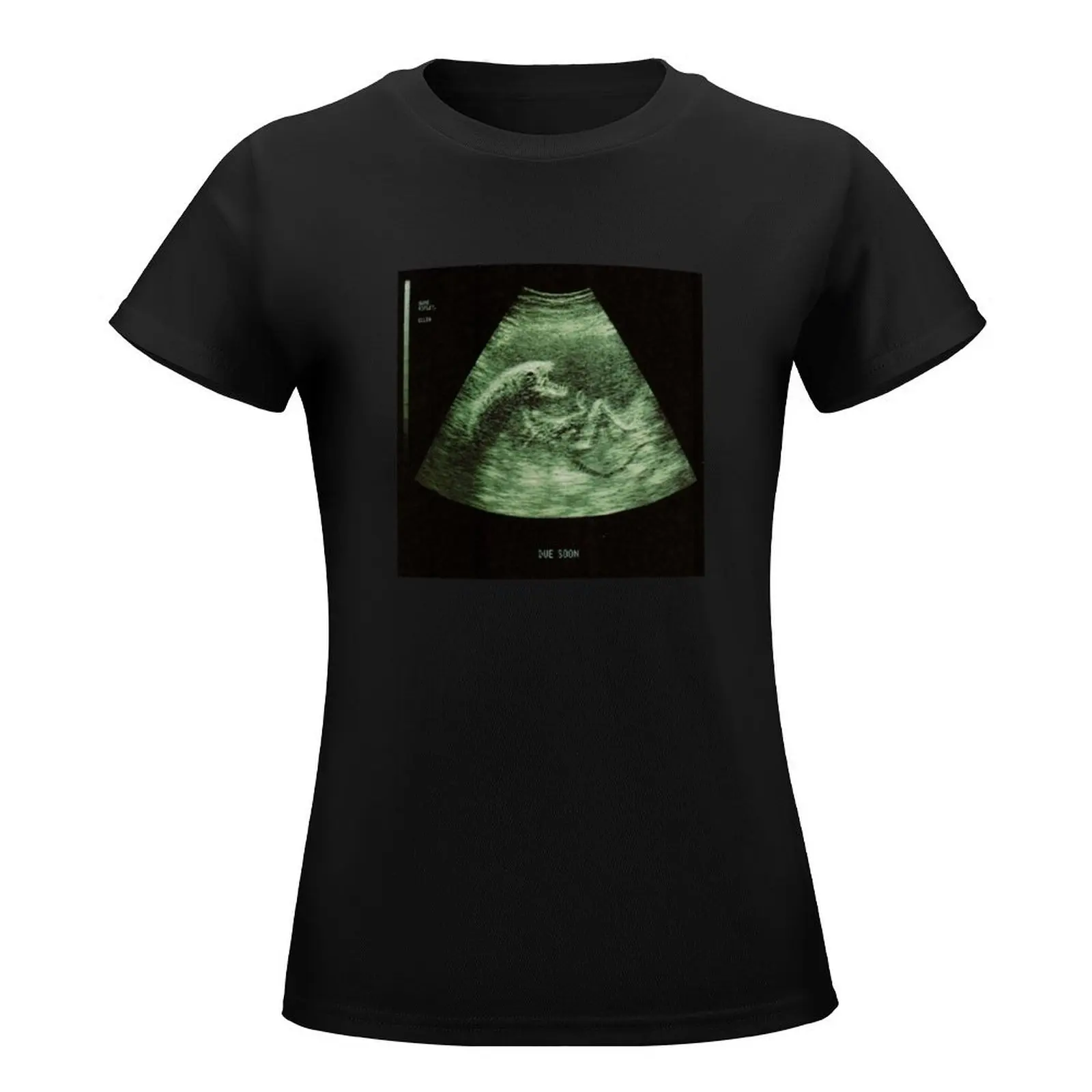 Alien Radiography, Due Soon T-Shirt korean fashion aesthetic clothes t-shirt dress for Women plus size sexy