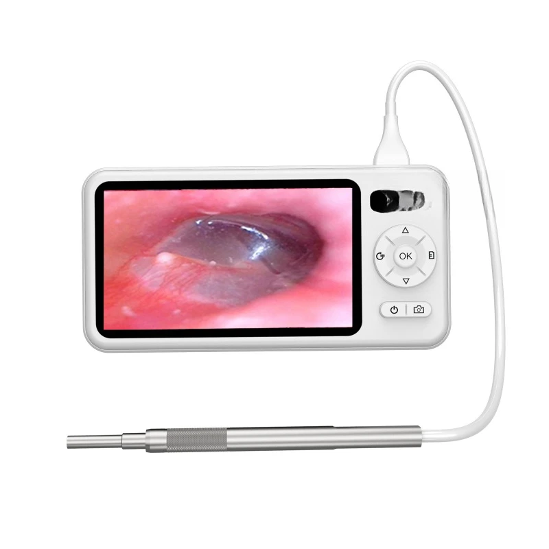 

Visual ear scoop Endoscope 5 inch high definition screen visual otoscope ears oral ear picking special visual ear scoop