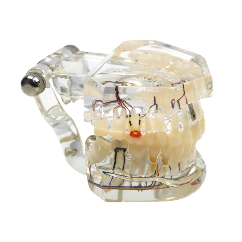 Dental Model Transparent Implant Pathological Teeth Model for Dentist Student Learning Studying Transparent Dental Supplies