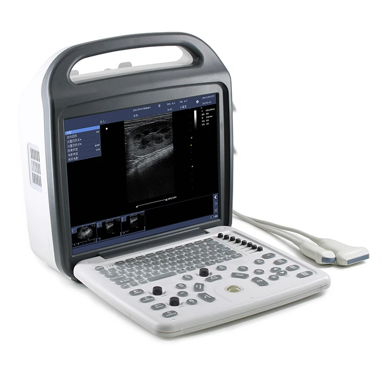 

CE ISO Approval Hospital Equipment Full Digital Doppler Laptop Ultrasonic Diagnostic Ultrasound Scanner