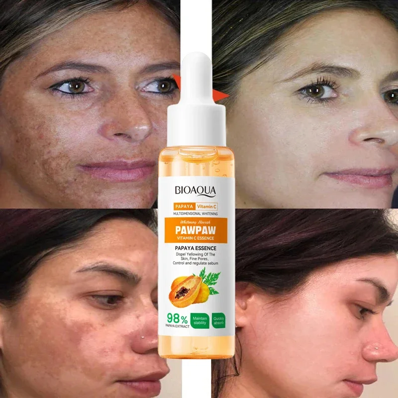 Whiten Freckle Papaya Serum, Eficaz Remover Melasma Dark Spots, Desvanecer-se Melanina, Loção Clareador, Beleza Saúde Cuidados Com A Pele