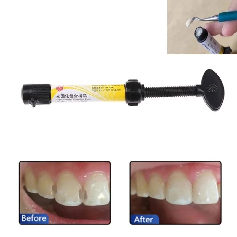 2.5g Dental Light Curing Composite Resin A1 A2 A3 Tooth Restoration Dental Materials Cavity Filling and Repair Dental Supplies view 2