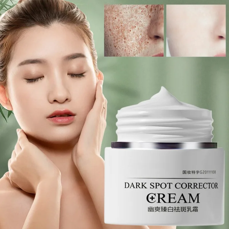 

30g Face Dark Spot Corrector Freckle Blemish Removal Moisturizing Whitening Beauty Health Skin Care Brighten Skin Tone Replenish