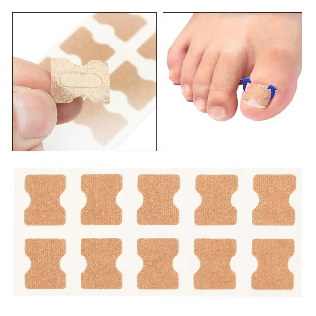 Toenail Corrector Stickers Toe Nail Elastic Corrector Tools Correction