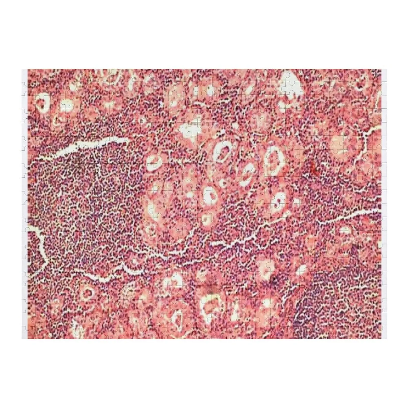 

Hashimoto's thyroiditis Jigsaw Puzzle Personalized Kids Gifts Jigsaw Custom Works Of Art Personalised Puzzle