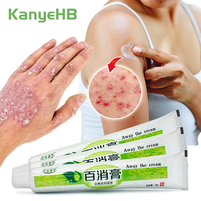 

3pcs Anti-itch Anti-inflammatory Medical Dermatitis Cream Rash Psoriasis Removal Cream Eczema Ointment Home Essentials A1302