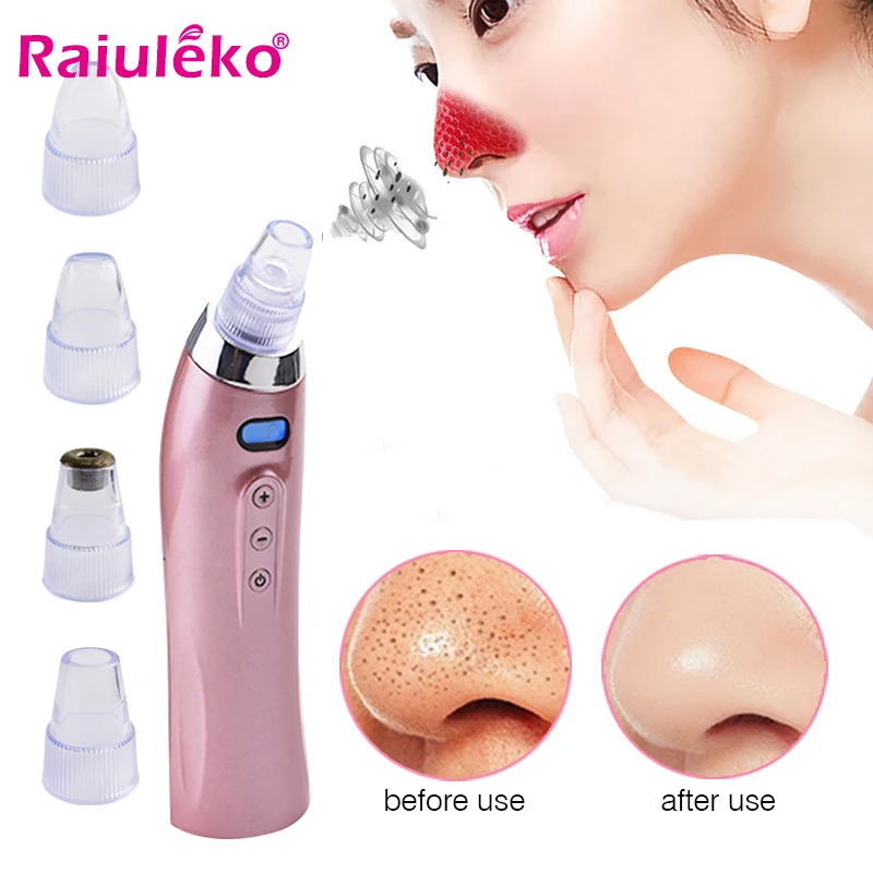 Blackhead Remover Nose T Zone Pore Vacuum Acne Pimple Removal Vacuum Suction Tool Facial Diamond Dermabrasion Machine Face Clean