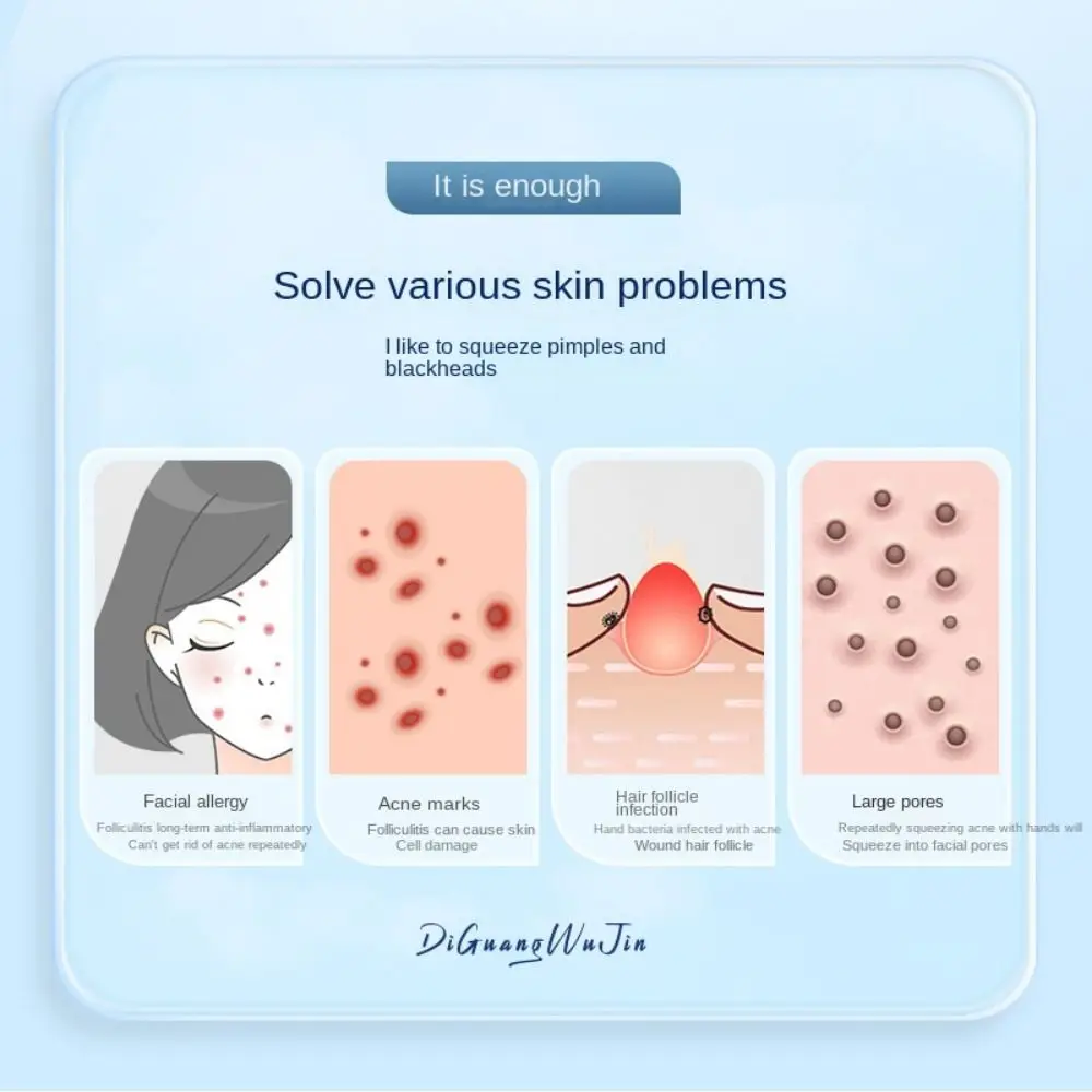 Whitehead Squeeze Extractor Puistje Popper Tool Comedondrukker Acne Smet Naald Porie Cleaner Naalden Puistjes Removal Tool