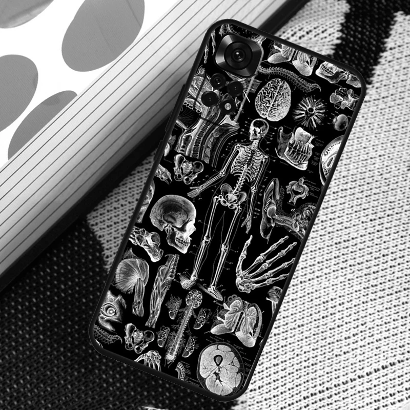 Skeleton  Bones Case For Xiaomi Redmi Note 12 8 9 10 11 Pro 9S 10S 11S 8T Redmi 10 12C 9C 10A 10C Coque