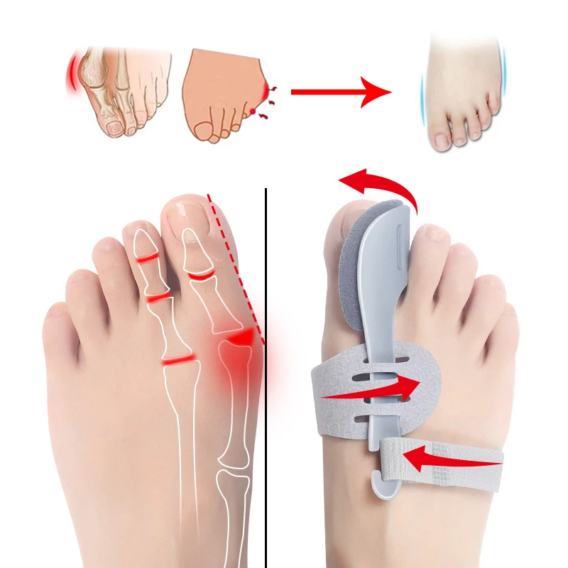 2pcs Big Bone Toe Bunion Splint Straightener Corrector,Foot Pain Relief Hallux Valgus Feet Care Protector Foot Care Tools