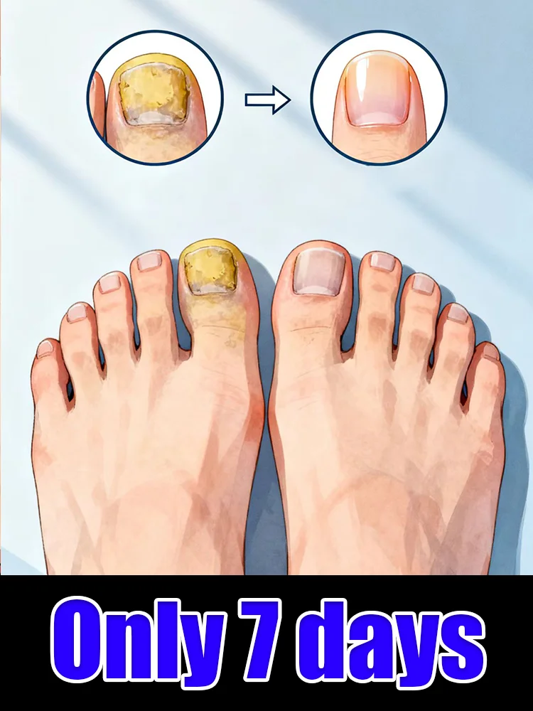 

A convenient tool for repairing discolored shell droppers