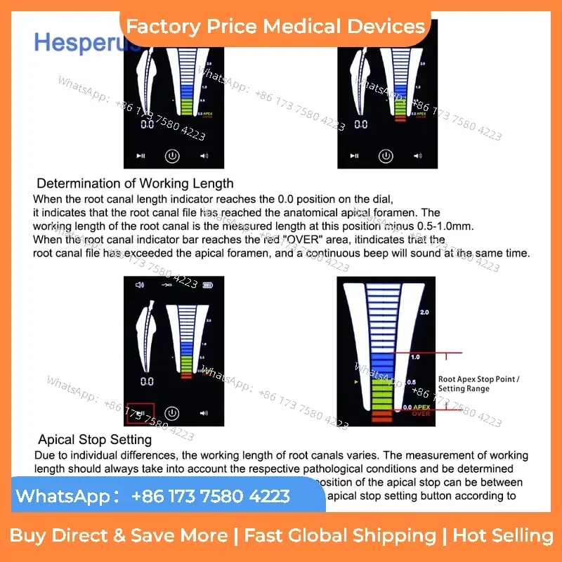 2026 NEW Equipment Cheap Apex Locator Touch Screen Root Canal Apex Locator fastshipping