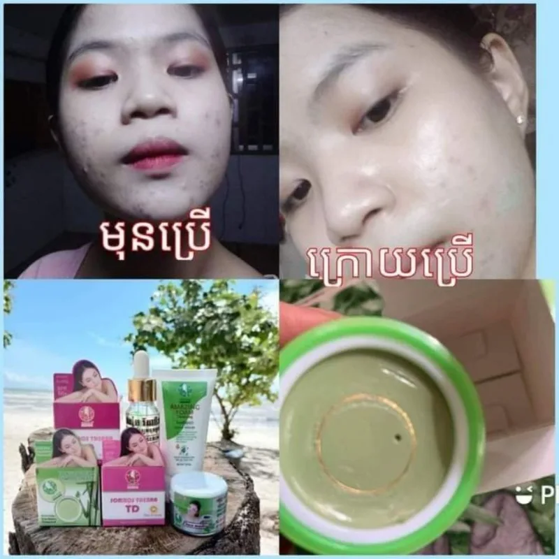 Brightening Anti Blemish Night Cream, Even Tone Radiance Face Moisturizer, Fade Dark Spots Dullness Corrector