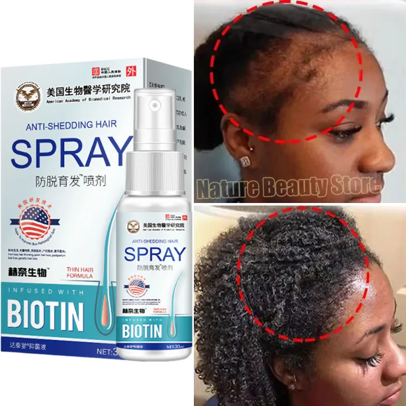 

Fast Ginger Hair Growth Serum Anti Hair Loss Baldness Repair Damaged Scalp Treatment Nourish Hair Root Care Products Women Men