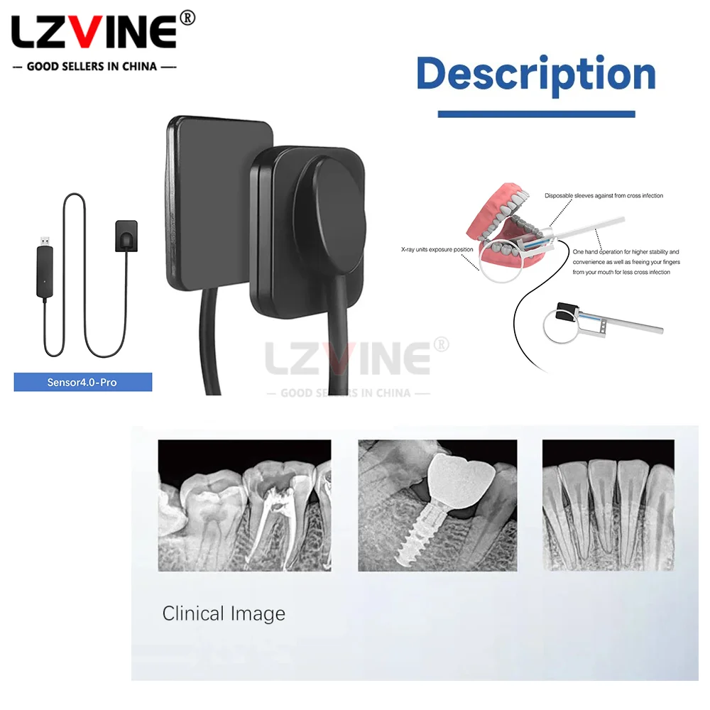 Рисунок 5 - Стоматологический датчик Рентгеновский