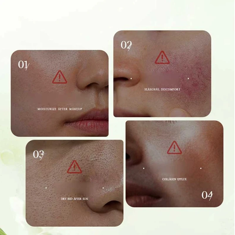 لوشن كينتيللا اسياتيكا مستخلص نباتي مستحلب مرطب منعش للتحكم في الزيت لوشن الأحماض الأمينية المهدئ 2026 #4