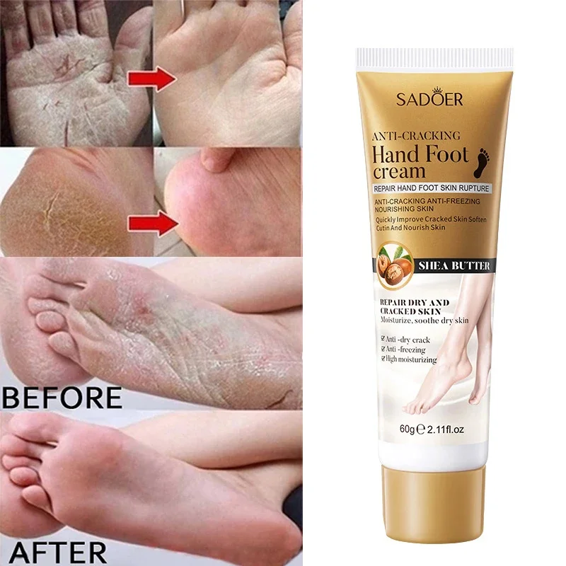 Crema antigrietas para pies y manos, mascarilla de reparación de talón agrietado, hidratante, blanqueador, removedor de piel muerta, productos para el cuidado de los pies