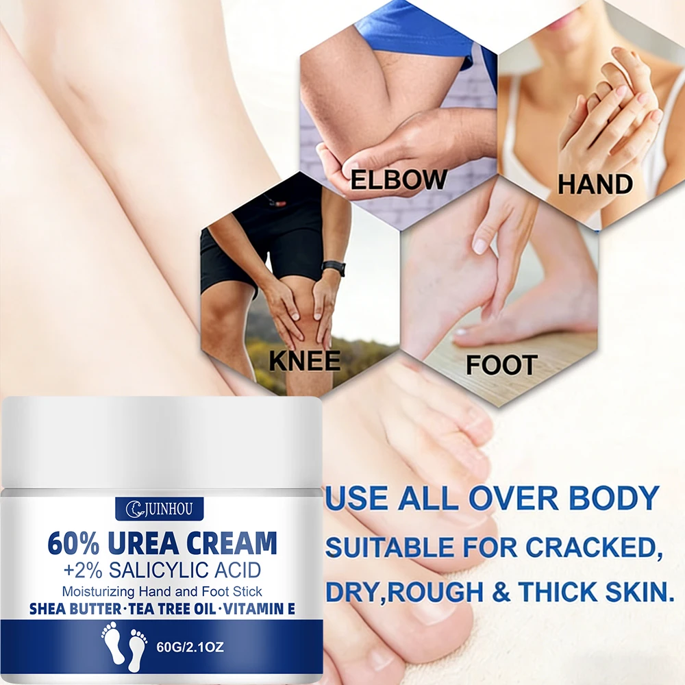 JUINHOU 60% Urea Fußcreme für rissige Fersen, trockene Haut, intensive Feuchtigkeitspflege, Hornhautentferner, glatte Haut, tägliche Fußpflege – Detail 4