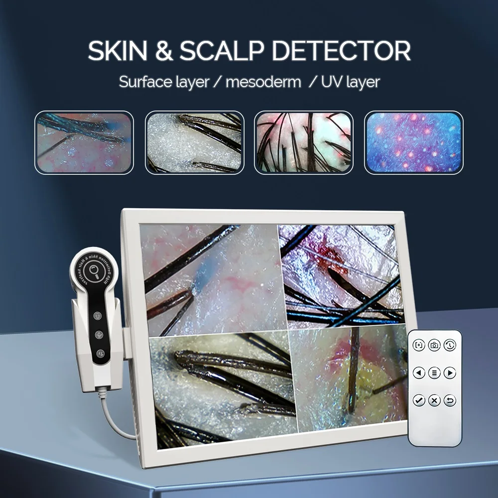 15 Inch HD Display 50/200X Professional Hair Follicle Detector Scalp Diagnostic Machine Skin Analyzer Oil Moisture Skin Tester