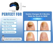 

1/2/4 Pcs Nail Fungus Light Device for Multiple Fingernails & Toenails
