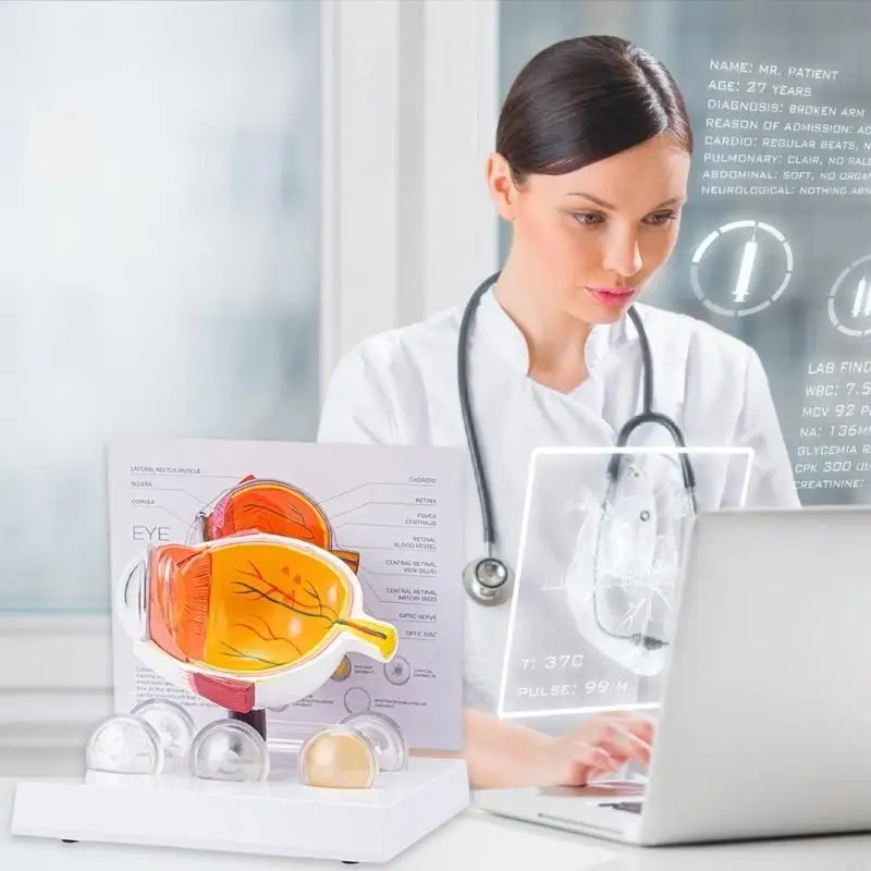 Menschliches pathologisches Augapfel Modell pathologisches Augapfel -Anatomie -Modell zum Unterrichten von Demonstration