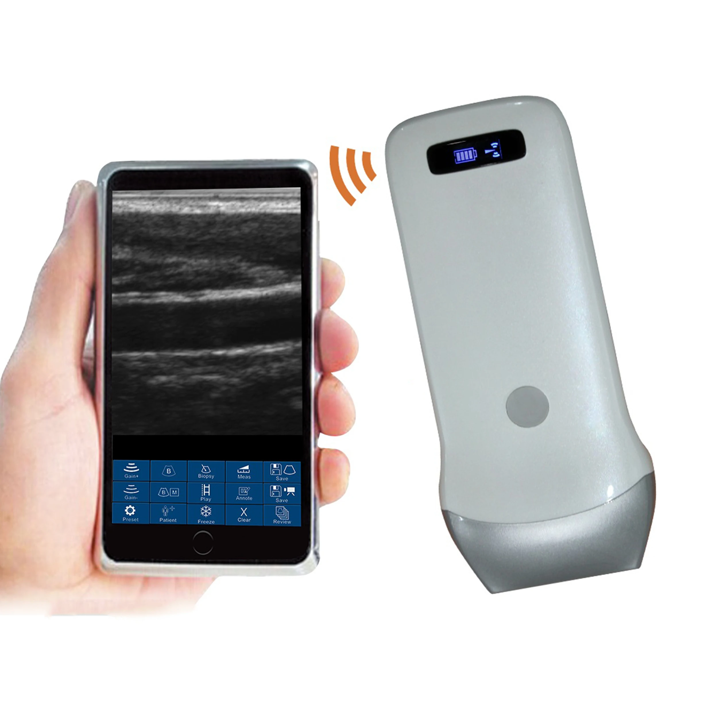 

Medical Instruments Portable Electronic Linear Array Scanner Smartphone USB WIFI Wireless Ultrasound Convex Probe