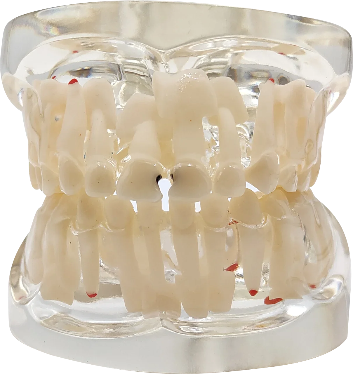 Dental Model For Children Deciduous Tooth Permanent Teeth Alternating Study Teathing Pediatric Dental Pathology Preventive Model